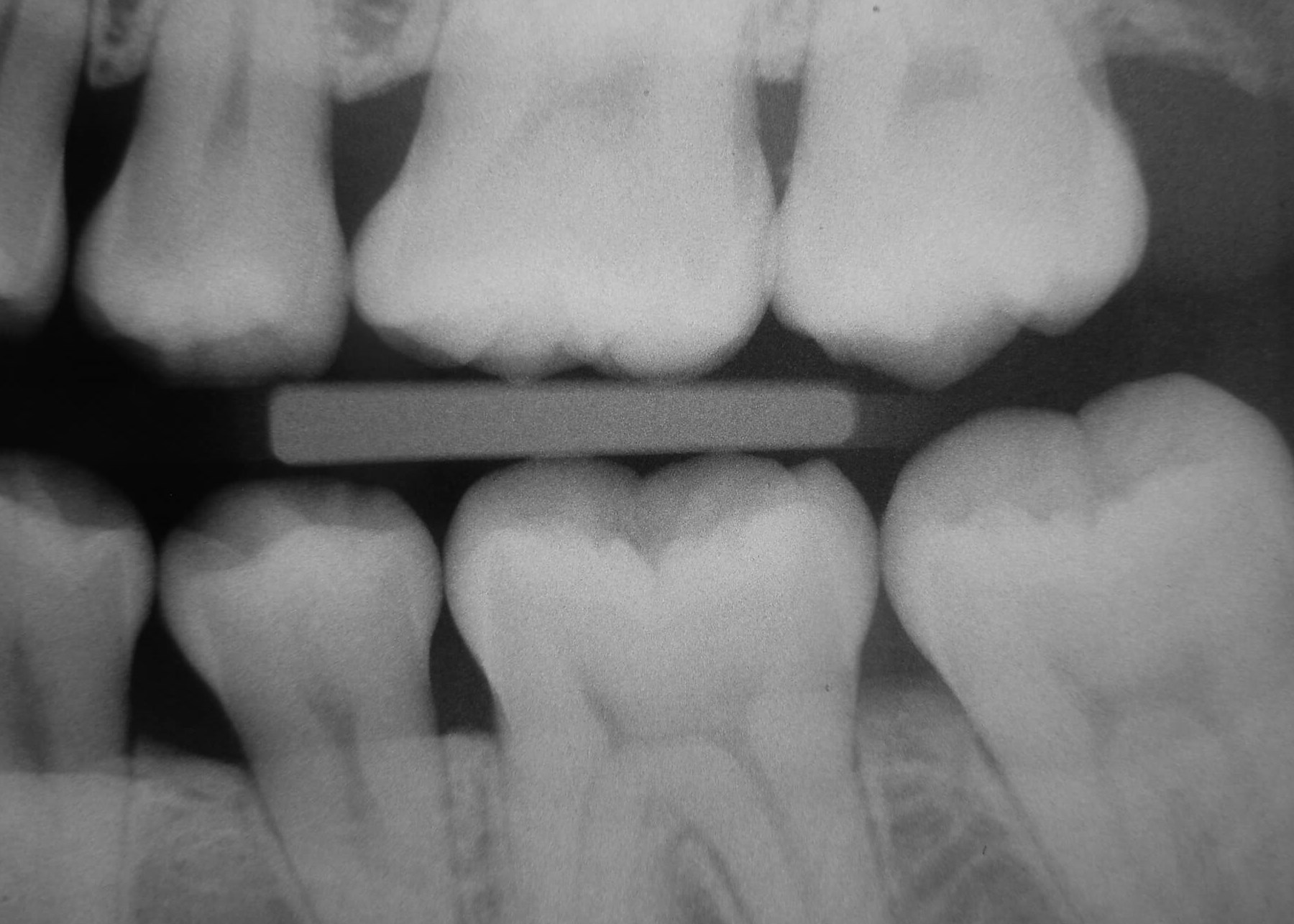 are dental x-rays necessary -